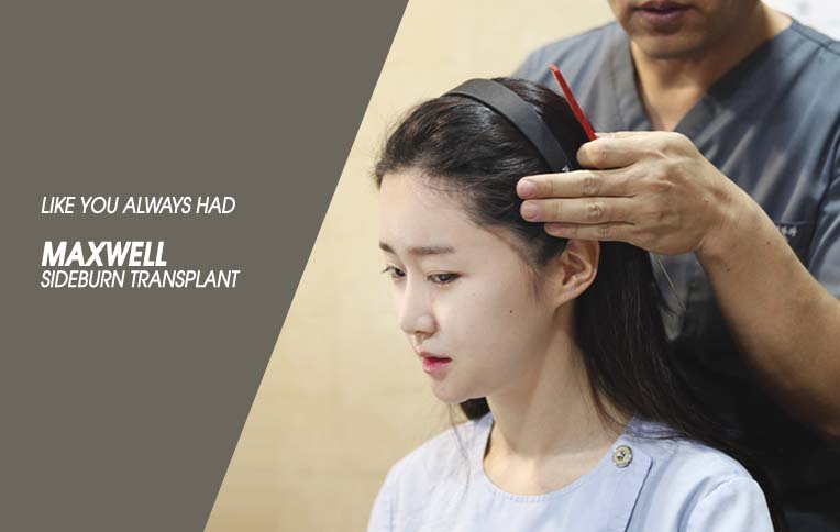 sideburn hair transplant korea